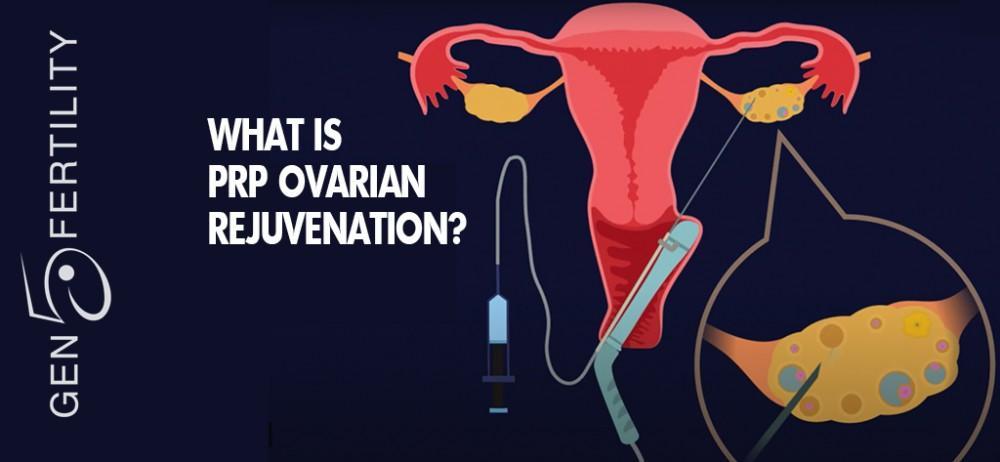 PRP Ovarian Rejuvenation Q & A
